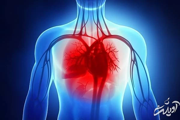 مشکلات دریچه قلب